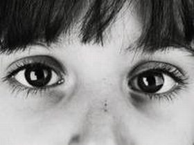 Глаза погибшего ребенка. Фото с сайта pravportal.ru