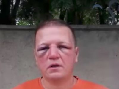 Избитый полицией крымчанин Сергей Чепелев